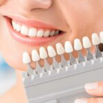 Dental Offers