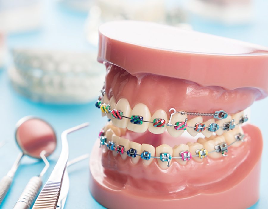 orthodontics-header